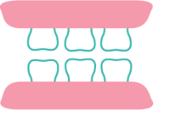Composite Fillings at Rainbowsmilesdental
