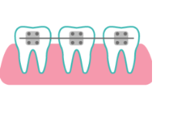 Composite Fillings at Rainbowsmilesdental