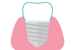 Composite Fillings at Rainbowsmilesdental