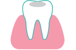 Composite Fillings at Rainbowsmilesdental
